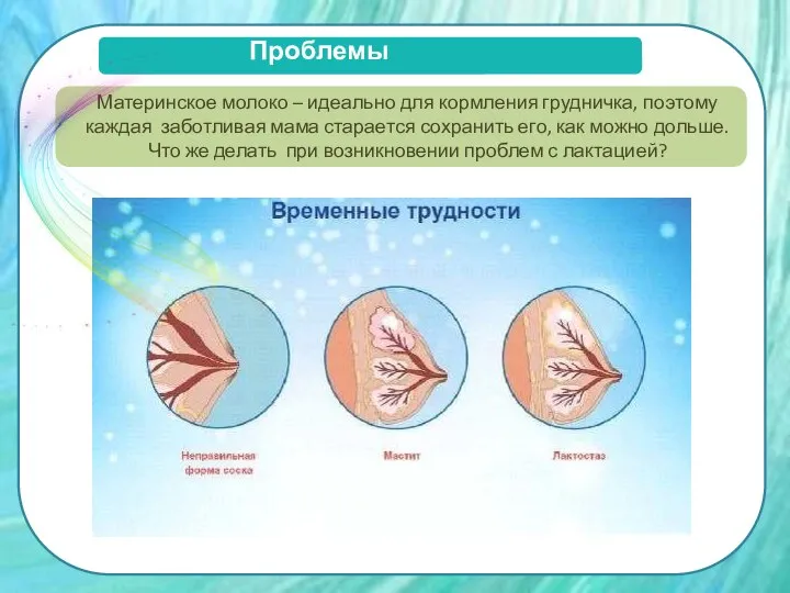 Проблемы лактации Материнское молоко – идеально для кормления грудничка, поэтому каждая