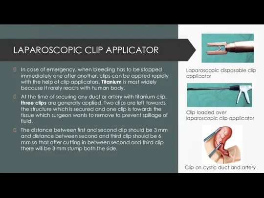 LAPAROSCOPIC CLIP APPLICATOR In case of emergency, when bleeding has to