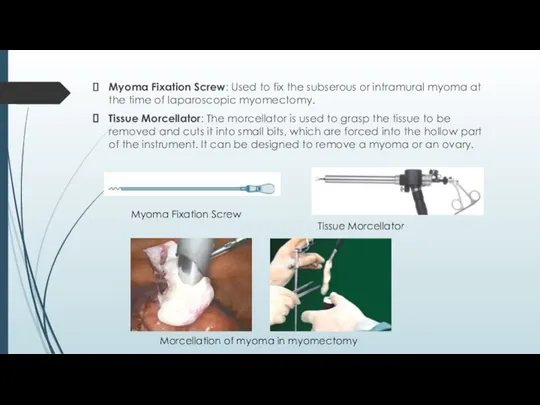 Myoma Fixation Screw: Used to fix the subserous or intramural myoma