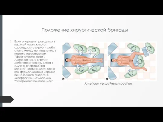 Положение хирургической бригады Если операция проводится в верхней части живота, французские