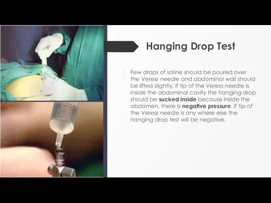 Hanging Drop Test Few drops of saline should be poured over