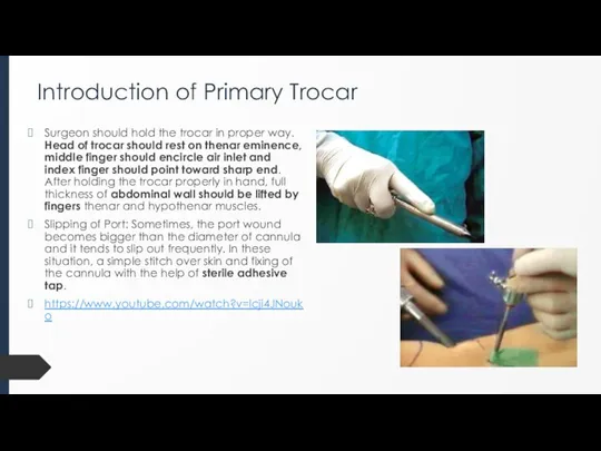 Introduction of Primary Trocar Surgeon should hold the trocar in proper