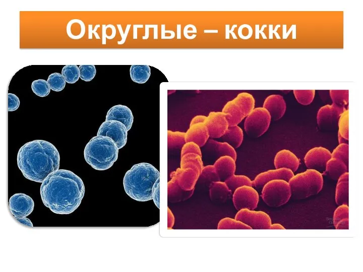 Округлые – кокки