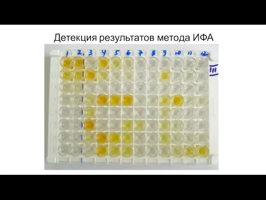 Детекция результатов метода ИФА