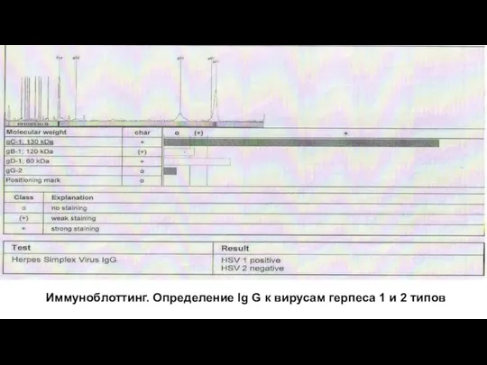 Иммуноблоттинг. Определение Ig G к вирусам герпеса 1 и 2 типов