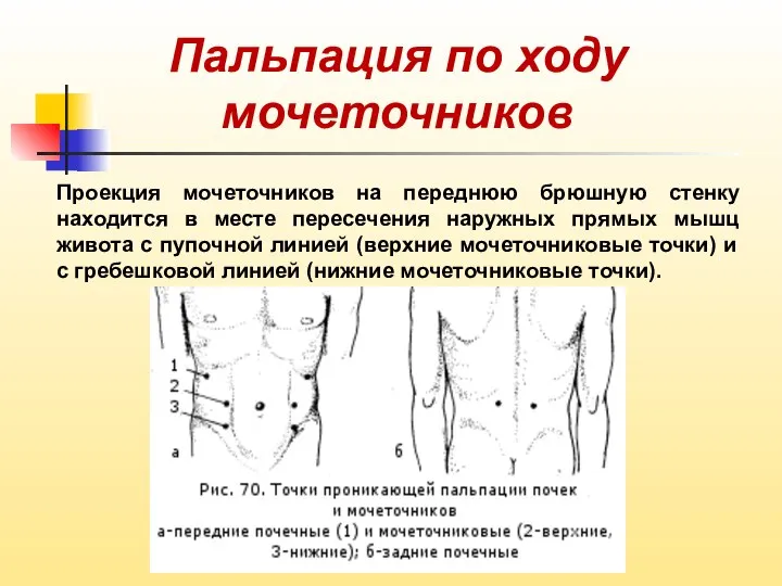 Пальпация по ходу мочеточников Проекция мочеточников на переднюю брюшную стенку находится