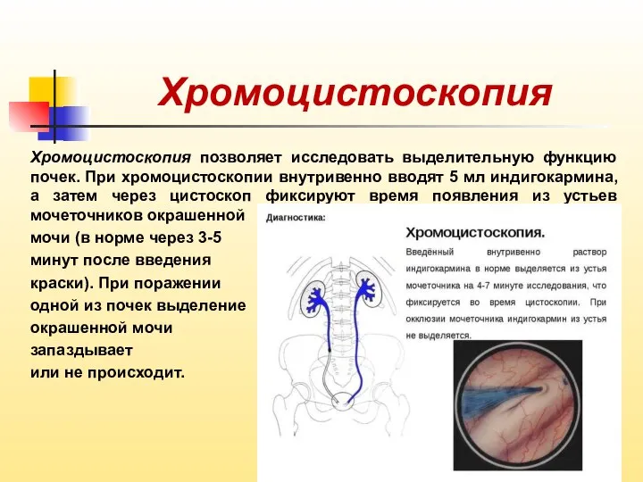 Хромоцистоскопия Хромоцистоскопия позволяет исследовать выделительную функцию почек. При хромоцистоскопии внутривенно вводят