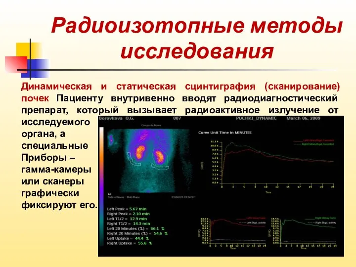 Радиоизотопные методы исследования Динамическая и статическая сцинтиграфия (сканирование) почек Пациенту внутривенно