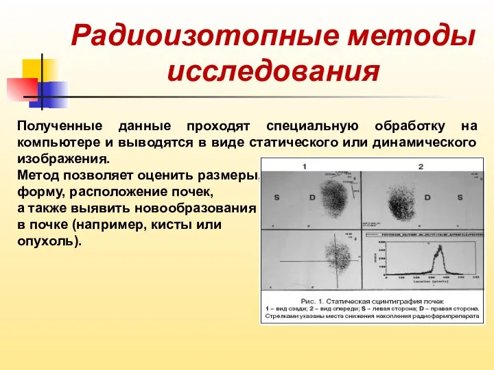 Радиоизотопные методы исследования Полученные данные проходят специальную обработку на компьютере и