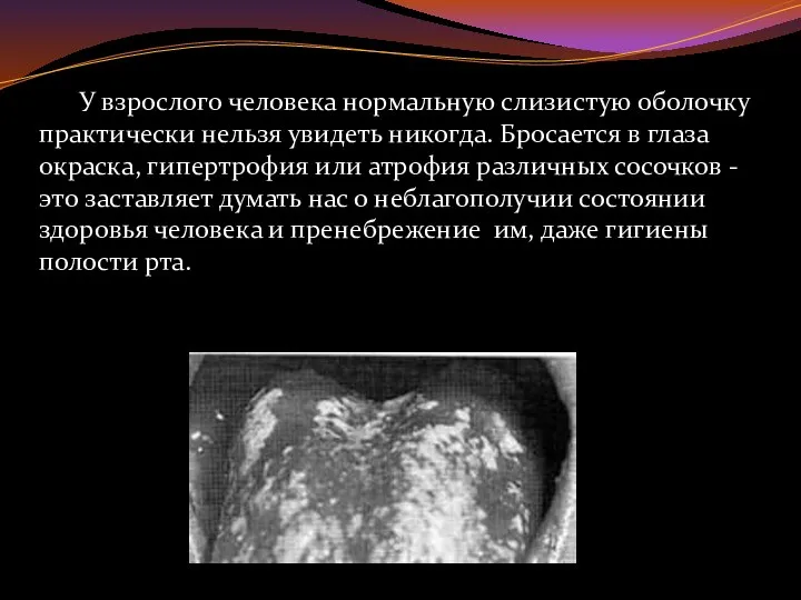 У взрослого человека нормальную слизистую оболочку практически нельзя увидеть никогда. Бросается