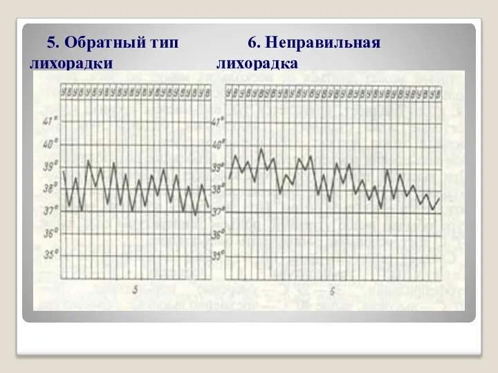 5. Обратный тип 6. Неправильная лихорадки лихорадка