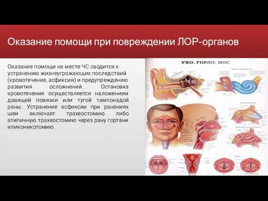 Оказание помощи при повреждении ЛОР-органов Оказание помощи на месте ЧС сводится