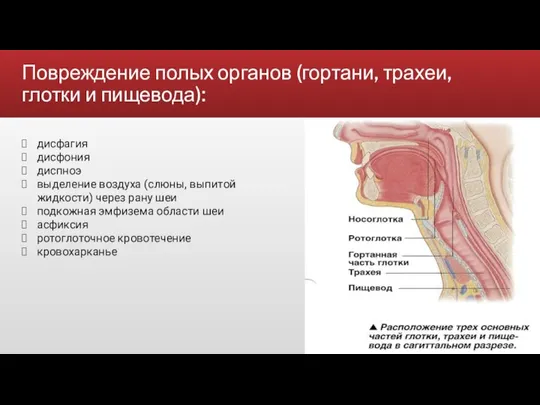 Повреждение полых органов (гортани, трахеи, глотки и пищевода): дисфагия дисфония диспноэ