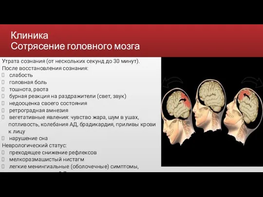 Клиника Сотрясение головного мозга Утрата сознания (от нескольких секунд до 30