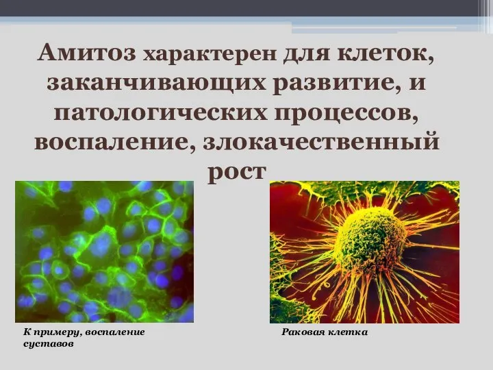 Амитоз характерен для клеток, заканчивающих развитие, и патологических процессов, воспаление, злокачественный