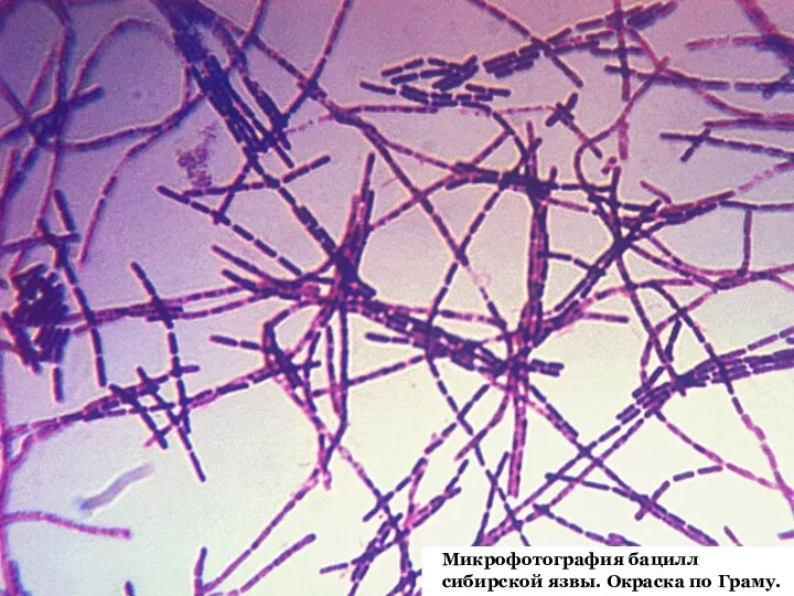29 Микрофотография бацилл сибирской язвы. Окраска по Граму.