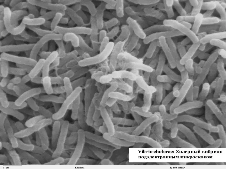 52 Vibrio cholerae: Холерный вибрион подэлектронным микроскопом