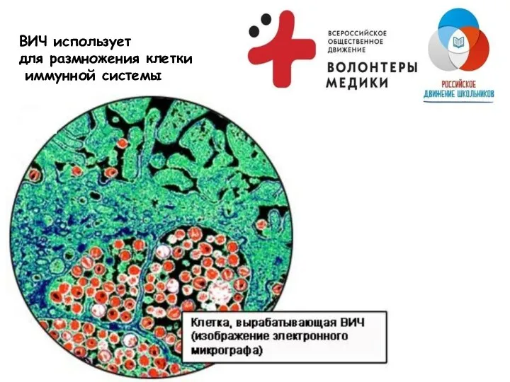 ВИЧ использует для размножения клетки иммунной системы