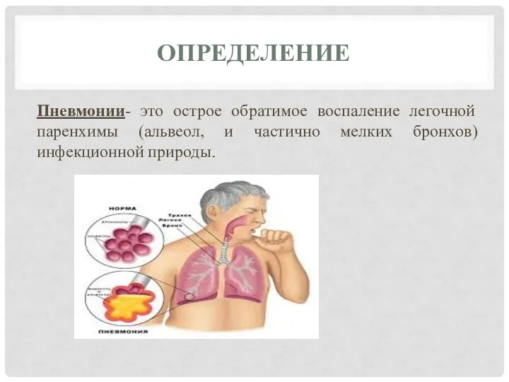 ОПРЕДЕЛЕНИЕ Пневмонии- это острое обратимое воспаление легочной паренхимы (альвеол, и частично мелких бронхов) инфекционной природы.