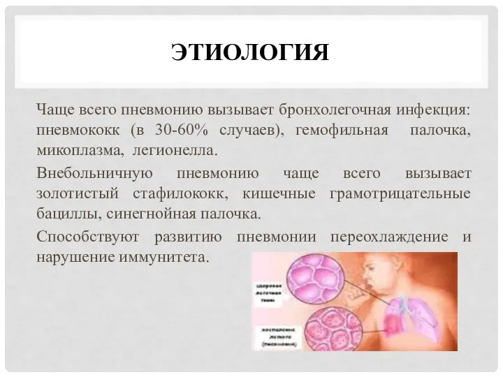 ЭТИОЛОГИЯ Чаще всего пневмонию вызывает бронхолегочная инфекция: пневмококк (в 30-60% случаев),