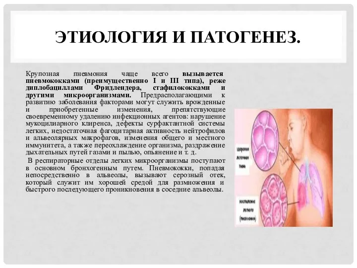 ЭТИОЛОГИЯ И ПАТОГЕНЕЗ. Крупозная пневмония чаще всего вызывается пневмококками (преимущественно I