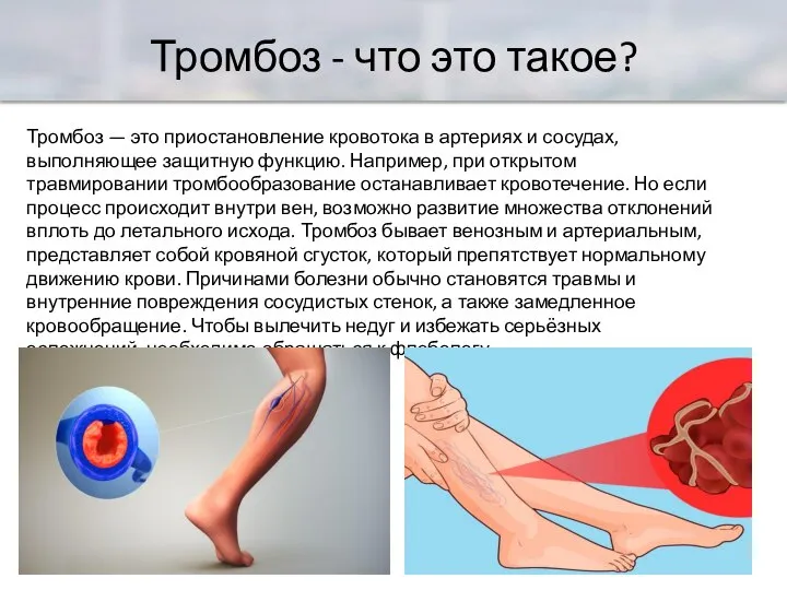 Тромбоз - что это такое? Тромбоз — это приостановление кровотока в