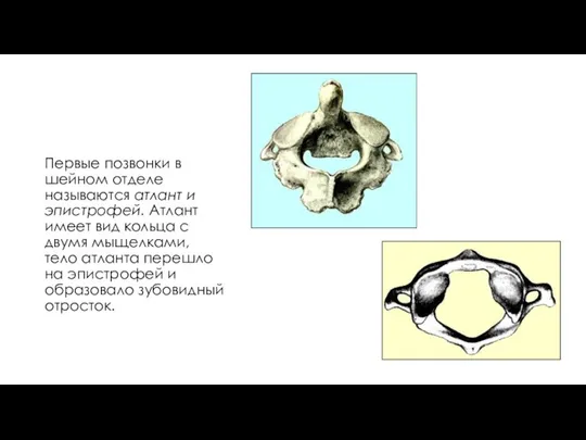 Первые позвонки в шейном отделе называются атлант и эпистрофей. Атлант имеет