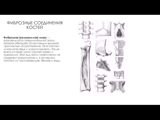 ФИБРОЗНЫЕ СОЕДИНЕНИЯ КОСТЕЙ Фиброзная (волокнистая) ткань — разновидность соединительной ткани, которая