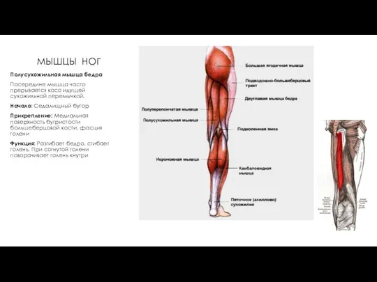 МЫШЦЫ НОГ Полусухожильная мышца бедра Посередине мышца часто прерывается косо идущей