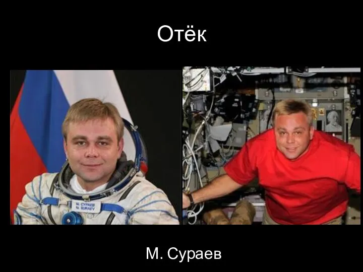 Отёк М. Сураев