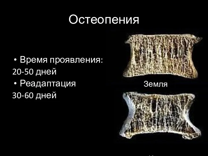 Остеопения Время проявления: 20-50 дней Реадаптация 30-60 дней Земля Космос