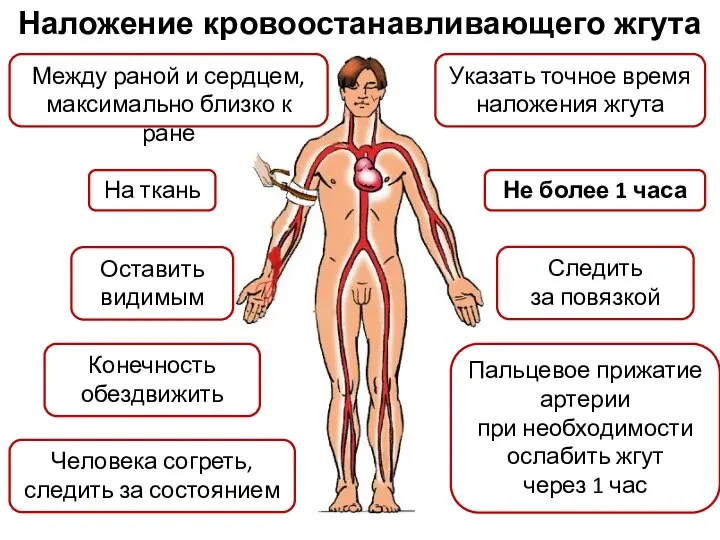 Наложение кровоостанавливающего жгута Конечность обездвижить Между раной и сердцем, максимально близко