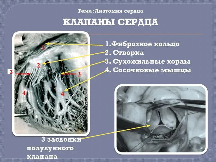 Тема: Анатомия сердца 1.Фиброзное кольцо 2. Створка 3. Сухожильные хорды 4.