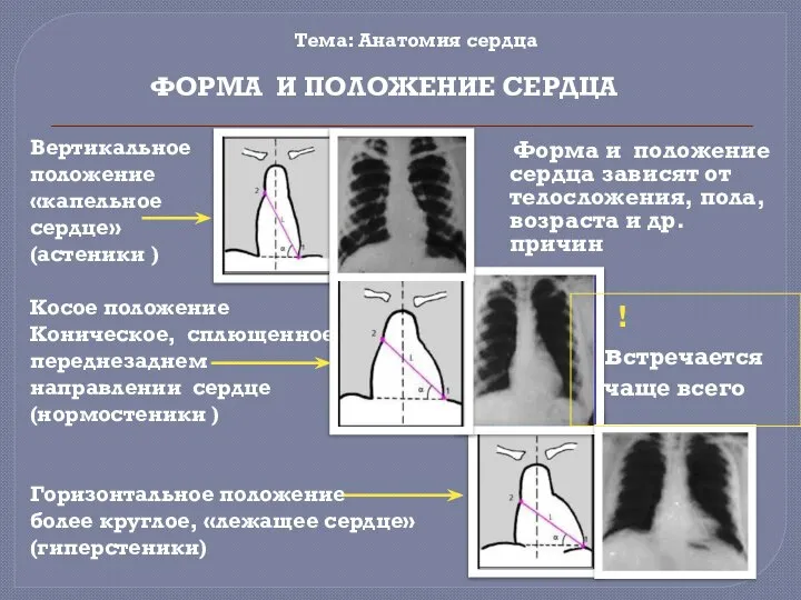 ФОРМА И ПОЛОЖЕНИЕ СЕРДЦА Форма и положение сердца зависят от телосложения,