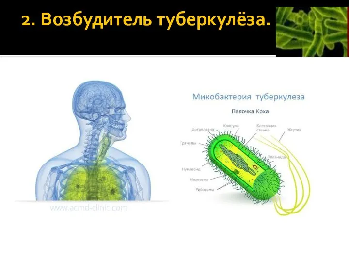 2. Возбудитель туберкулёза.