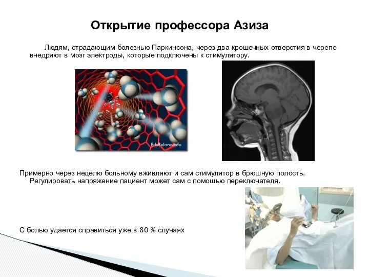 Открытие профессора Азиза Людям, страдающим болезнью Паркинсона, через два крошечных отверстия