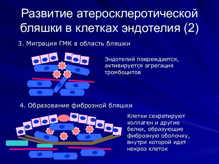 Развитие атеросклеротической бляшки в клетках эндотелия (2) 3. Миграция ГМК в