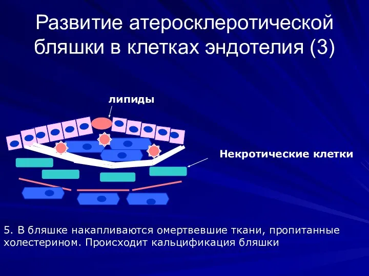 Развитие атеросклеротической бляшки в клетках эндотелия (3) липиды 5. В бляшке