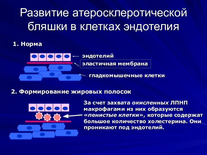 Развитие атеросклеротической бляшки в клетках эндотелия 1. Норма эндотелий эластичная мембрана