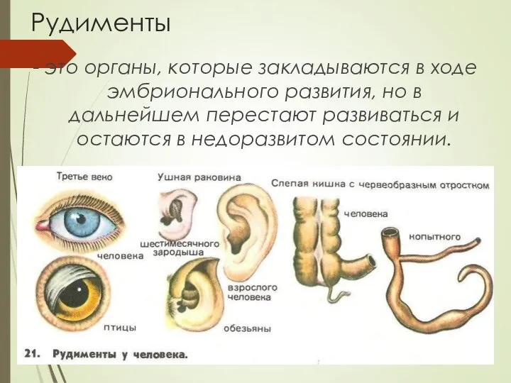 Рудименты - это органы, которые закладываются в ходе эмбрионального развития, но