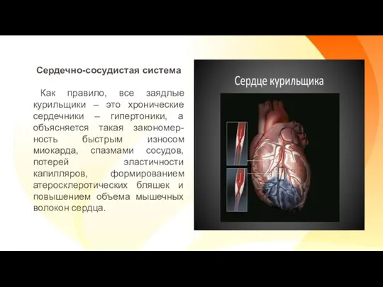 Сердечно-сосудистая система Как правило, все заядлые курильщики – это хронические сердечники