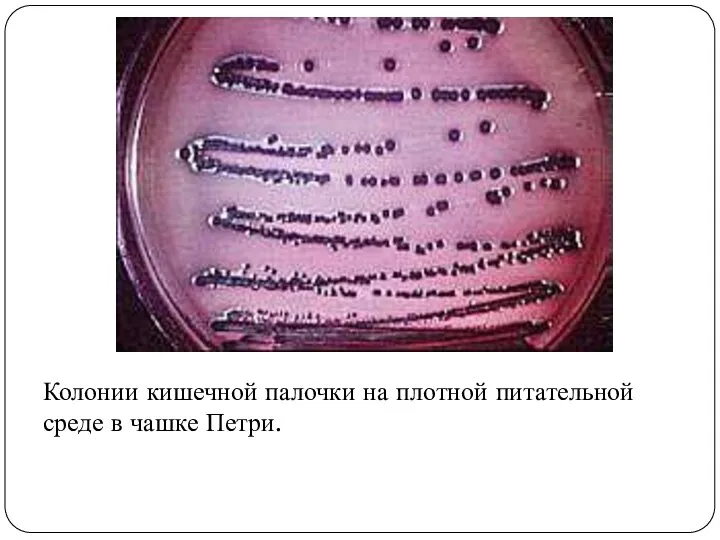 Колонии кишечной палочки на плотной питательной среде в чашке Петри.