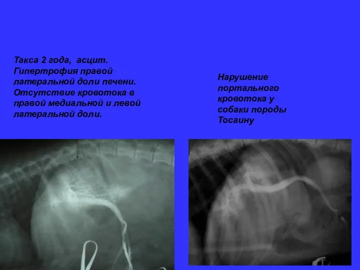 Такса 2 года, асцит. Гипертрофия правой латеральной доли печени. Отсутствие кровотока