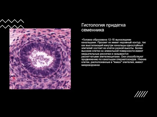 Гистология придатка семенника Головка образована 12-15 выносящими канальцами. Просвет их имеет
