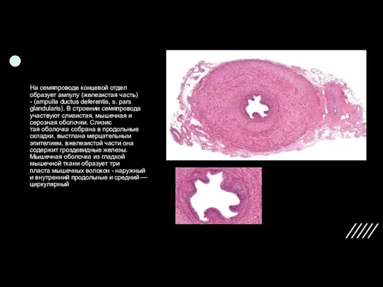 На семяпроводе концевой отдел образует ампулу (железистая часть) - (ampulla ductus