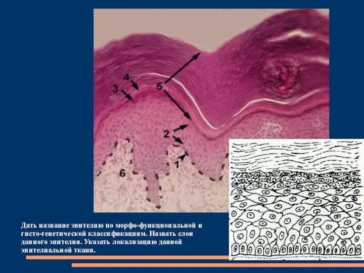 Дать название эпителию по морфо-функциональной и гисто-генетической классификациям. Назвать слои данного