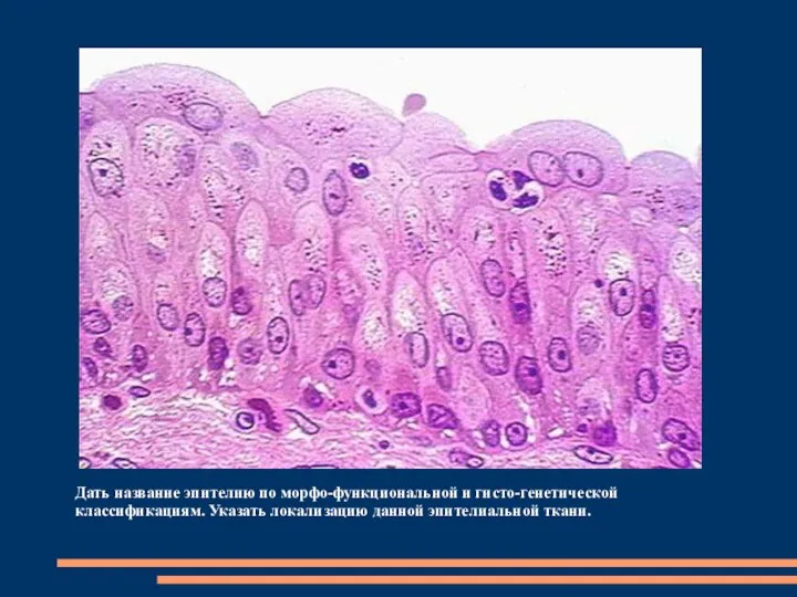 Дать название эпителию по морфо-функциональной и гисто-генетической классификациям. Указать локализацию данной эпителиальной ткани.