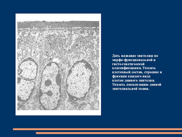 Дать название эпителию по морфо-функциональной и гисто-генетической классификациям. Указать клеточный состав,