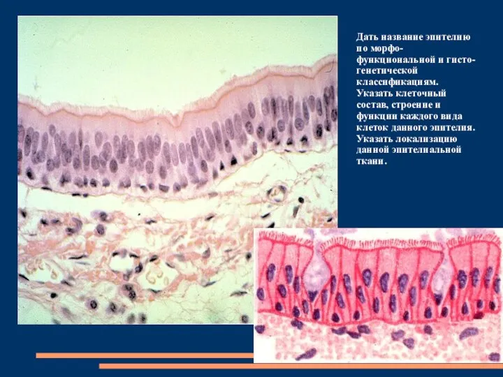 Дать название эпителию по морфо-функциональной и гисто-генетической классификациям. Указать клеточный состав,
