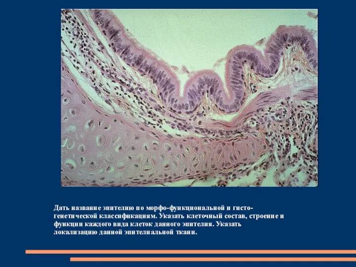 Дать название эпителию по морфо-функциональной и гисто-генетической классификациям. Указать клеточный состав,